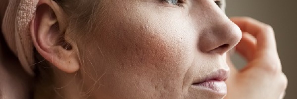 piros arc és fájó ízületek fájdalom a bal karban a könyökízületben
