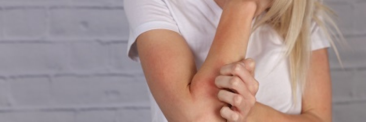 hogyan kell kezelni az artritisz pikkelysömörét)