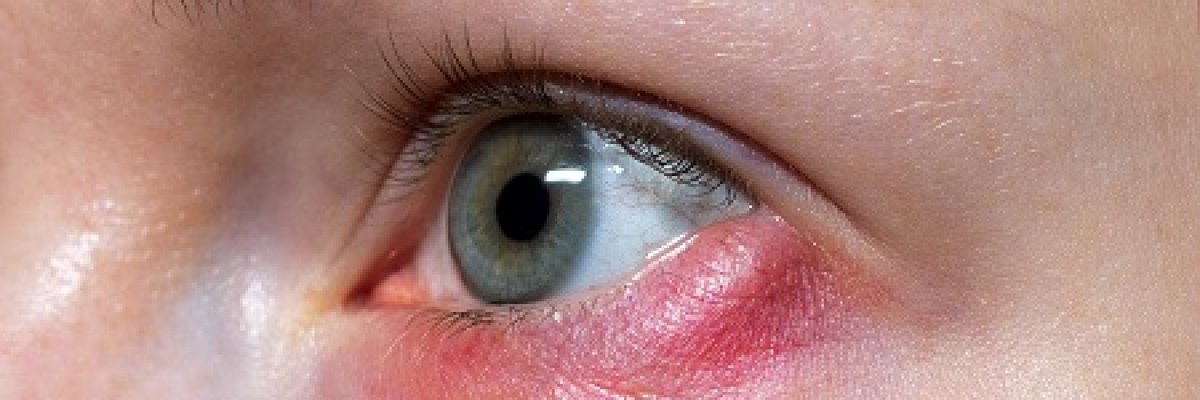 urban decay eye primer anti aging svájci anti aging értékesítési képviselő