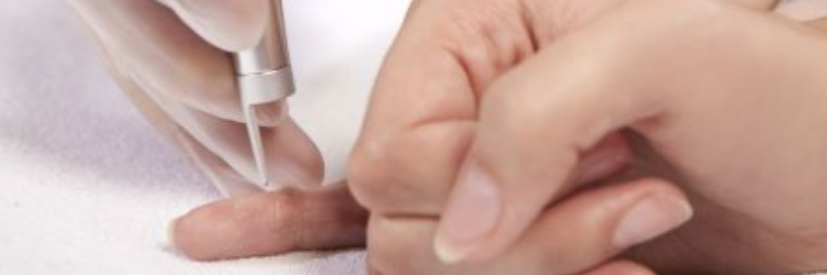 Mikor kell eltávolítani a bőrkinövést?