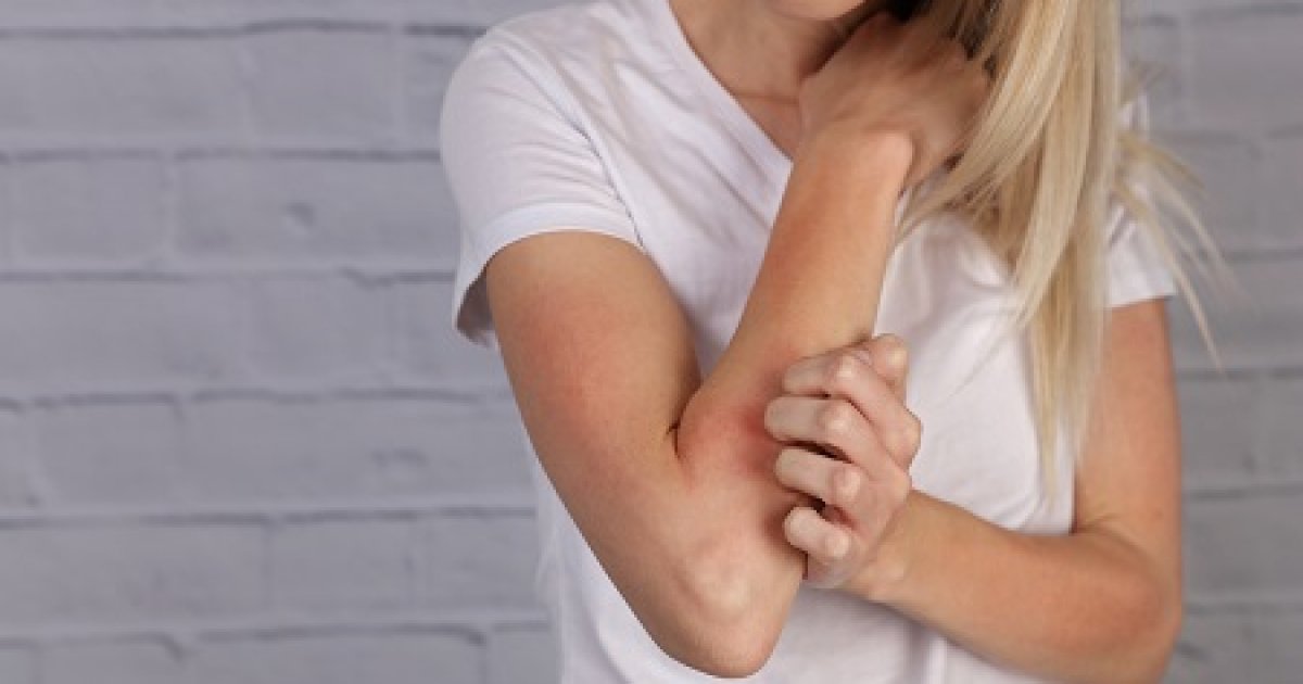 pikkelysömör kenőcsök és krémek kezelésére a pikkelysömör kezelése a stádiumtól függően