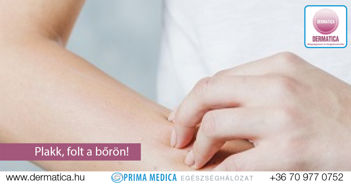 vörös folt a bőrön onkológia)