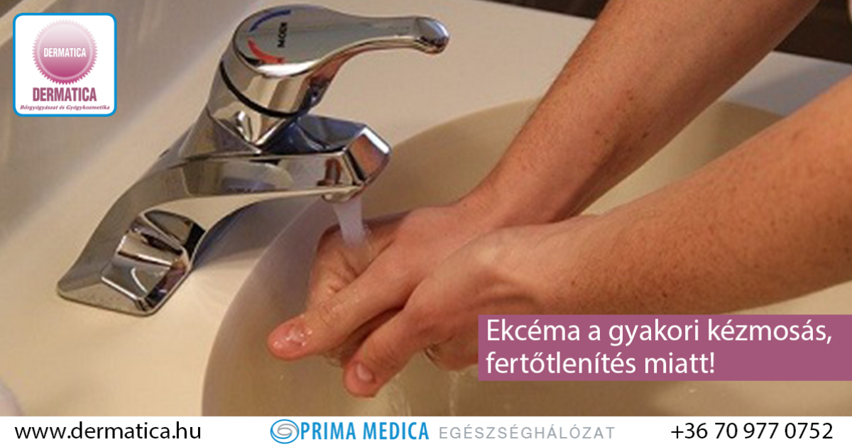 belobbant ekcéma