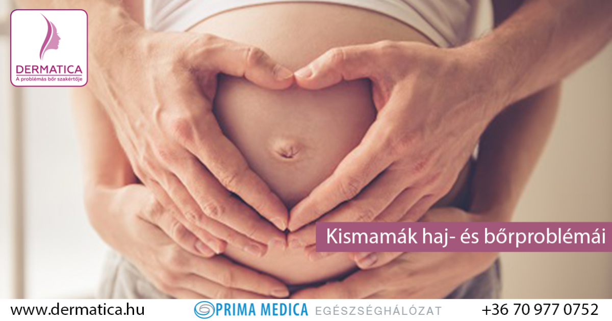 a striák elmúlnak a fogyásban)