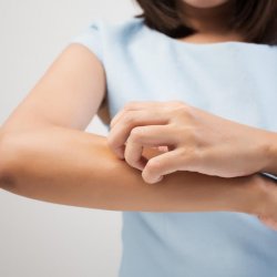 8 dolog, ami csalánkiütést okozhat