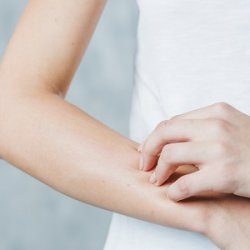Kerek, viszkető foltok a végtagokon? <strong>mikro</strong>bás ekcéma is lehet