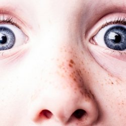 Foltok a bőrön: ártalmatlan, vagy veszélyes?