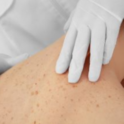 A rosszindulatú bőrgyógyászati elváltozások differenciáldiagnosztikája - összefoglaló