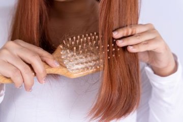 3 gyakori bőrgyógyászati ok a hajhullás mögött
