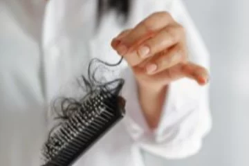 Pikkelysömör is lehet foltos hajhullás oka – így lehet megállítani