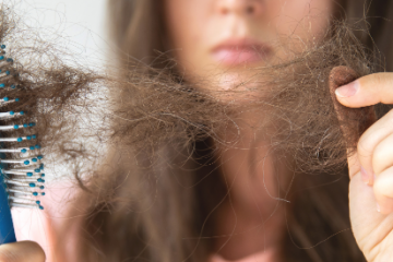 Pikkelysömör is lehet foltos hajhullás oka – így lehet megállítani