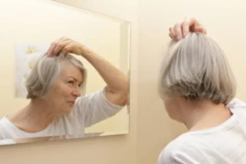A feje tetején kopaszodik? Ilyen okai lehetnek a férfias hajhullásnak nőknél
