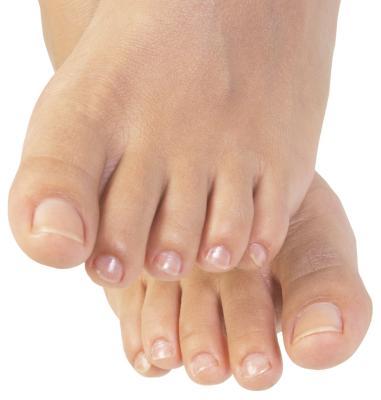 A láb mycosisa - tünetek és kezelés