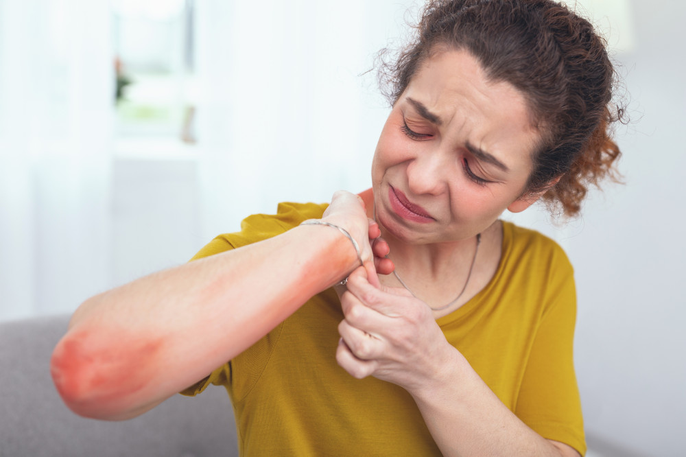 Atópiás dermatitisz tünetei - Dermatica Bőrgyógyászat és Kozmetika